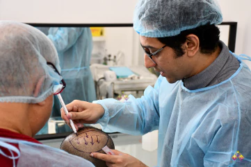 Master-certification-in-hair-transplant-may-2023-8